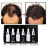 টাক মাথায় চুল গজায় ১০০%-Dexe Hair Lotion Anti Hair Loss-UK. image 4