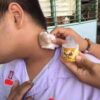 Marika Body Tonner-Thailand-ঘাড় ও বগলের কালো দাগ দূর করুন. image 3