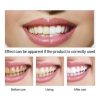 দাঁতকে ঝকঝকে সাদা করুন ৩ দিনেই-Lanbena teeth Whitining. image 3