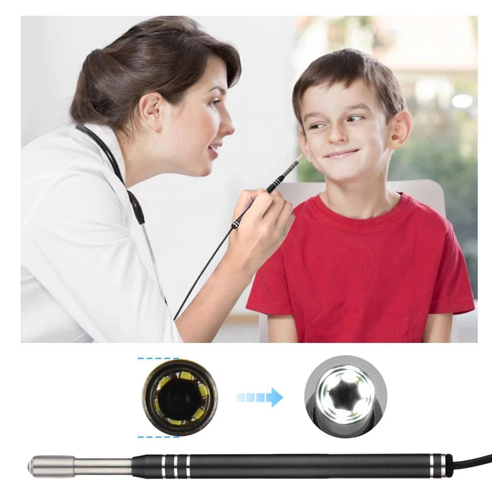 Ear Cleaning Endoscope Visual Camera, Ear Wax Removal Tool 3 in 1 image 2